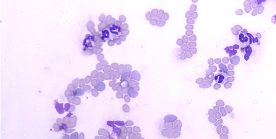 Zomedica TRUVIEW AI microscopy platform